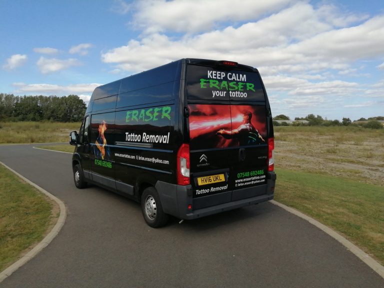 Look Out For Our Laser Removal Van On The Move